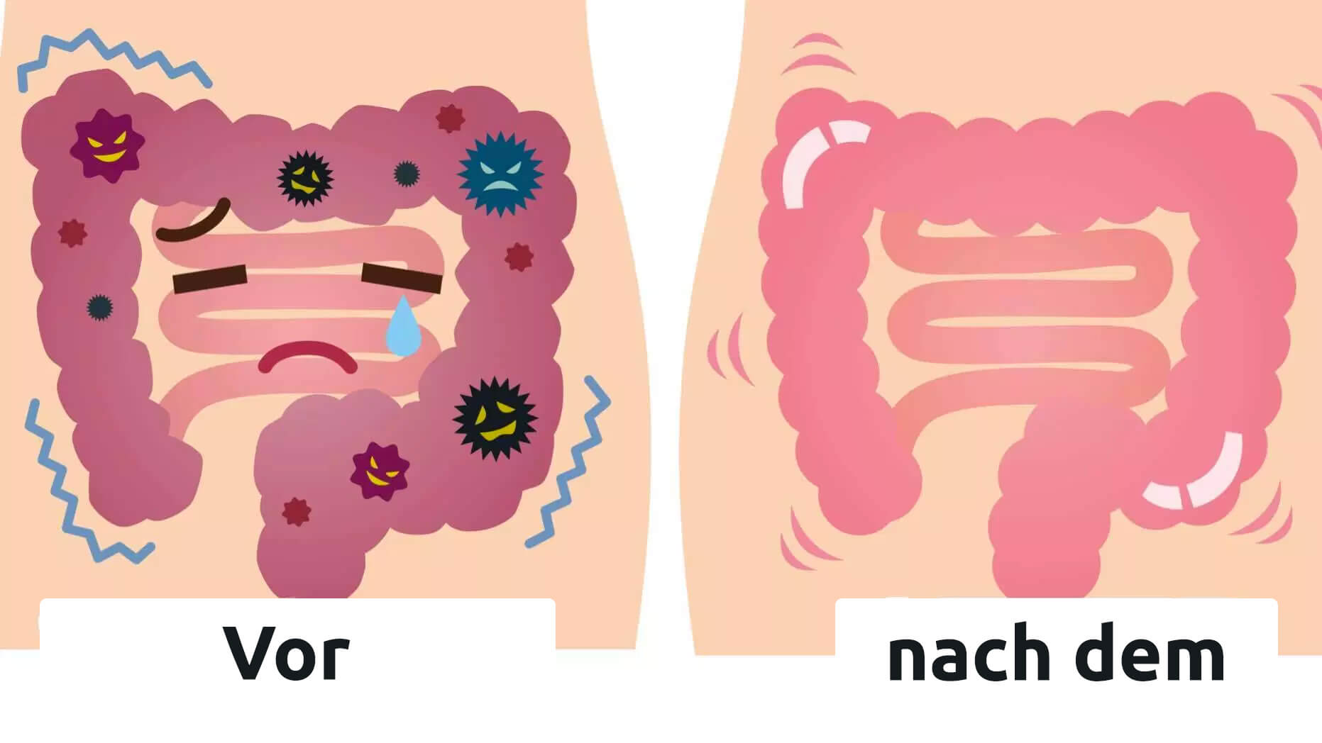 Abtransport der Giftstoffe, Fettschmelzer und Blutdrucksenker (With images) - Toxine im darm